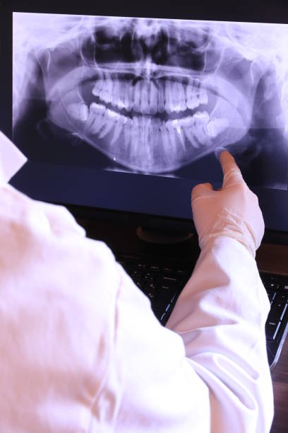 Best Emergency Dental Filling Replacement  in Terville, WA