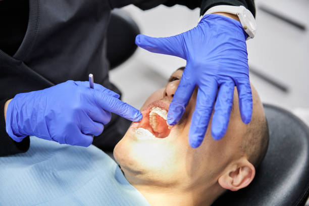 Best Dentist for Tooth Abscess  in Terville, WA