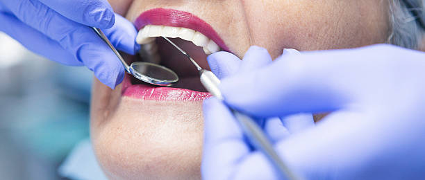 Best Chipped Tooth Repair Near Me  in Terville, WA